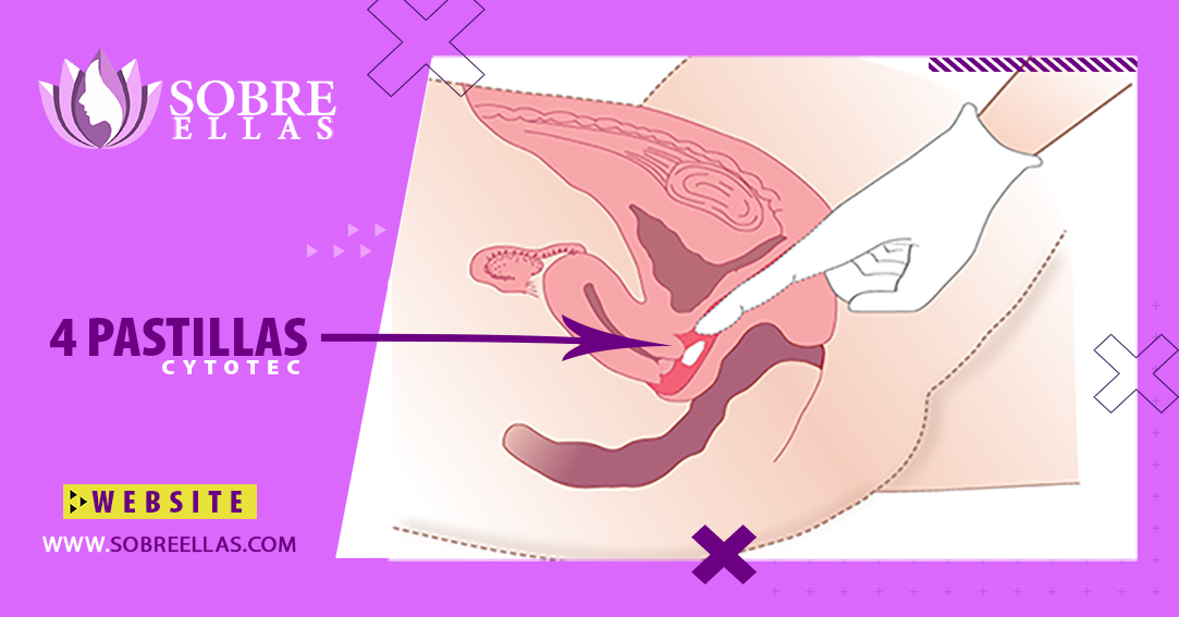 Ilustración de mujer introduciendo pastillas abortivas Cytotec en su vagina
