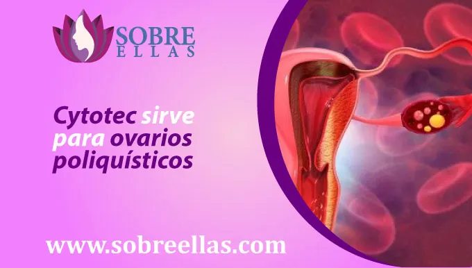 Se observa la ilustracion de un ovario y al lado un titulo que dice :Cytotec sirve para ovarios poliquísticos